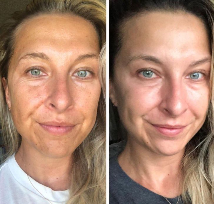 Anti-Wrinkle Essential Oil with VC & Lutein