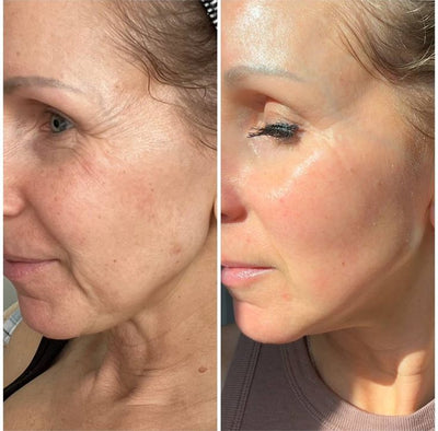 Anti-Wrinkle Essential Oil with VC & Lutein